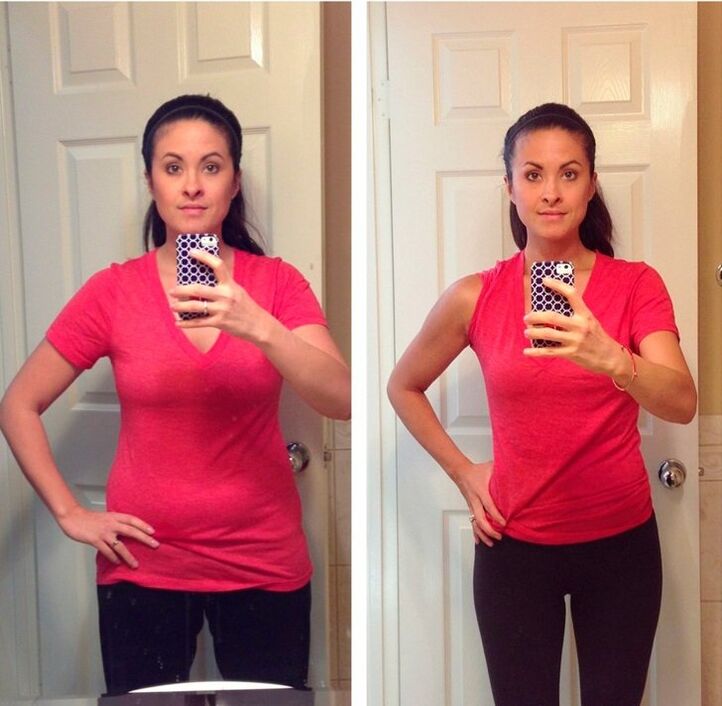result of weight loss with a significant initial weight